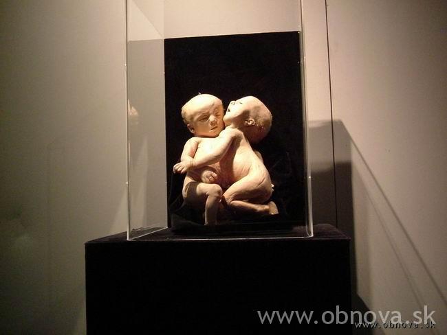 palo-mnichov-2003leto-024