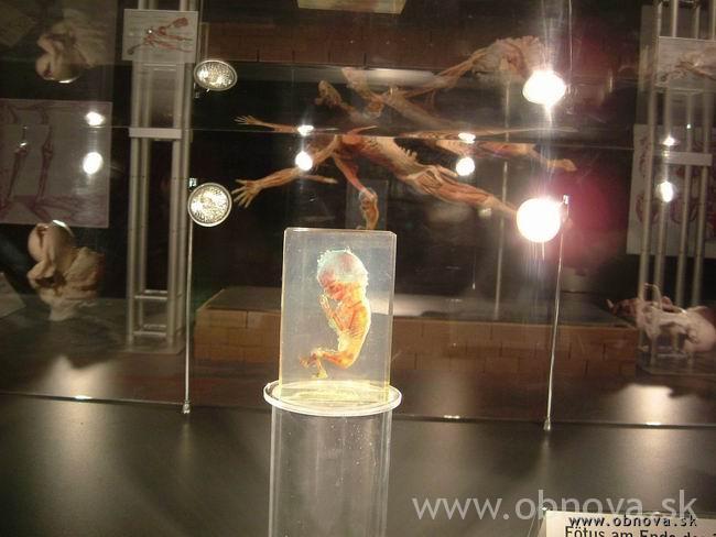 palo-mnichov-2003leto-031